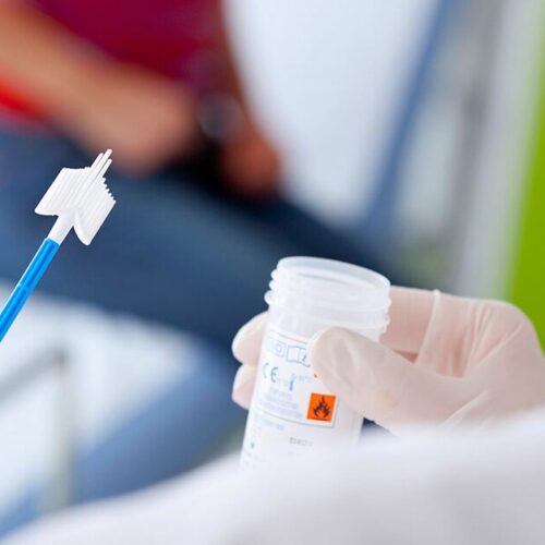 Δήμος Βέροιας: Δωρεάν τεστ Παπανικολάου (test Pap) την Παγκόσμια Ημέρα της Γυναίκας, 8 Μαρτίου