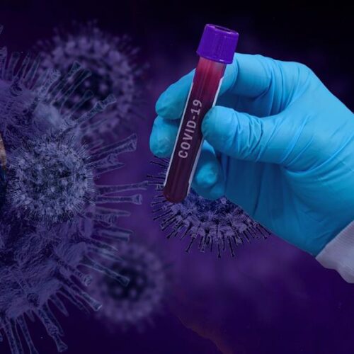 Η Εθνική Επιτροπή Εμβολιασμών «αδειάζει» τον Γκίκα Μαγιορκίνη  / Ταυτόχρονα τα εμβόλια γρίπης και κορωνοϊού