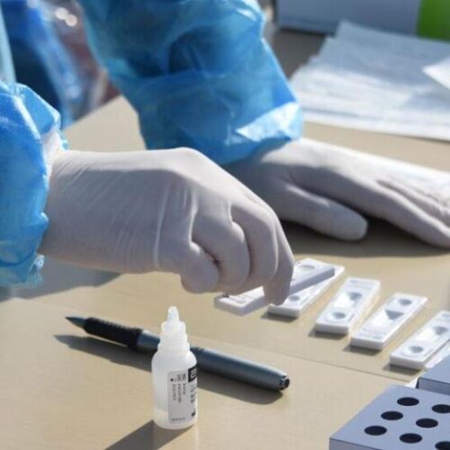 Δωρεάν rapid test στο Δήμο Βέροιας | Από Μ. Δευτέρα 18 έως Μ. Σάββατο 23 Απριλίου